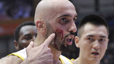 铁肘之下阿巴斯血染赛场 裁判争议判罚引主场震怒