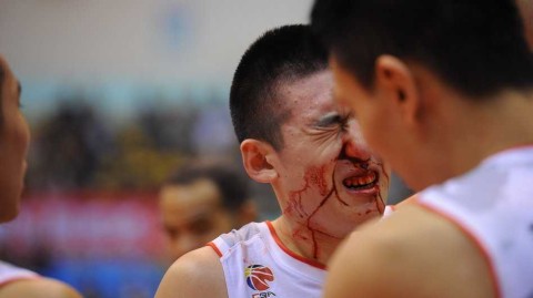 铁军新星血染赛场：菜鸟付豪鼻梁骨折依旧笑对，诠释八一篮球不屈之魂