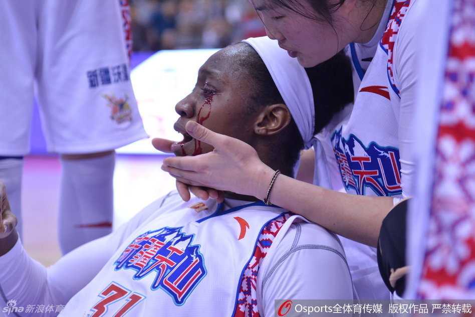 WCBA总决赛浴血战场:新疆外援查尔斯眼角开裂,用坚韧定义“新疆精神” 遭到意外肘击的查尔斯痛苦地捂住面部,但鲜血依然止不住地从指缝中渗出,剧烈的疼痛让她瞬间倒地。