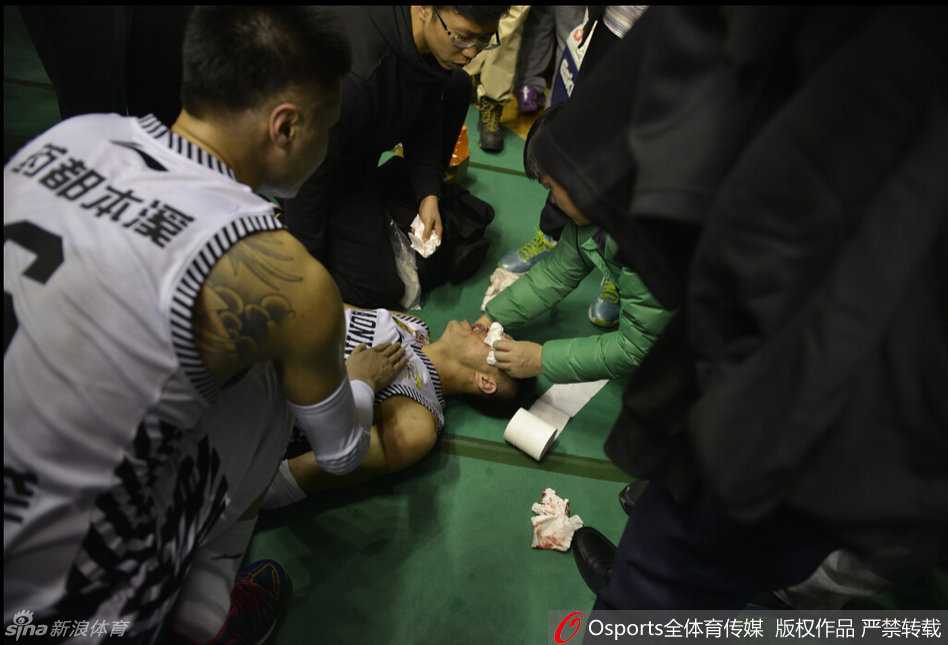 赛场惊魂:郭艾伦遭水瓶袭击血洒本溪,文明底线何在 队医蹲在地上紧急为郭艾伦处理伤口,郭艾伦表情痛苦,眼眶周围已经肿胀,白色球衣上沾染了点点血迹。