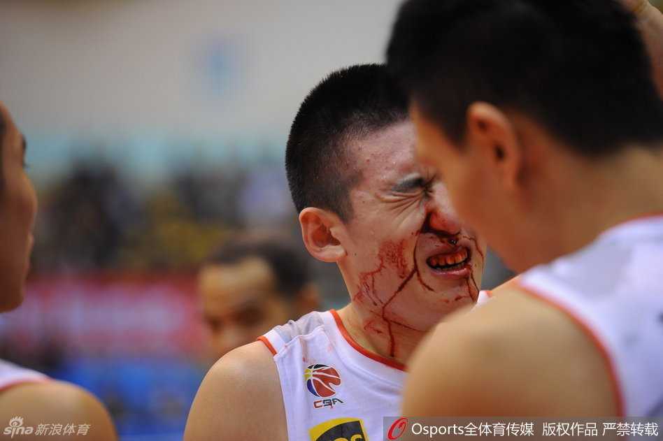 年轻的付豪痛苦地倒地在木地板上，他紧紧捂着面部，殷红的鲜血从指缝间渗出，染红了球衣的前襟，眉头因剧痛紧紧拧在一起。