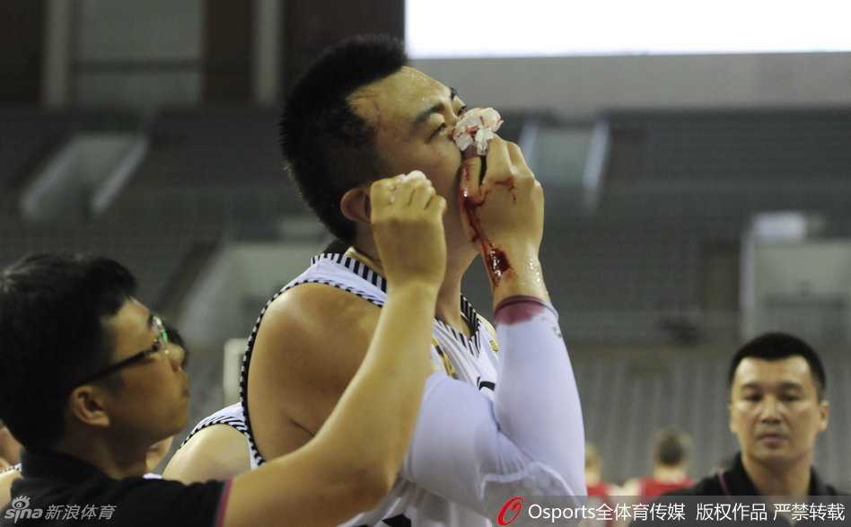 铁血硬汉韩德君赛场血染风采 鼻骨断裂不改擎天柱本色 激烈的篮下卡位战中,韩德君如同一座铁塔般奋力跃起,却在与对方防守球员的猛烈碰撞中,面部瞬间被击中,鲜血立刻染红了他的衣襟,场面令人揪心不已。