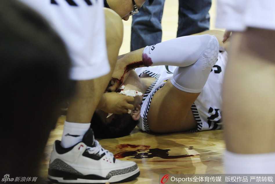铁血硬汉韩德君赛场血染风采 鼻骨断裂不改擎天柱本色 辽宁男篮的队医神情严肃地蹲在地上,手持医用纱布和止血用具,小心翼翼地处理韩德君血流不止的鼻部伤口,场边的担架已经准备就绪。