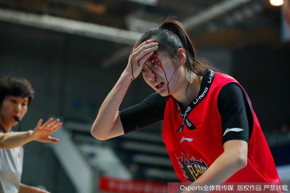 赛场铁血玫瑰:山西女篮郭子瑄头部重创血流满面仍昂首离场 队医紧急为郭子瑄进行止血处理,从特写镜头可以看到伤口情况较为严重,但她紧咬牙关,默默承受着剧痛。