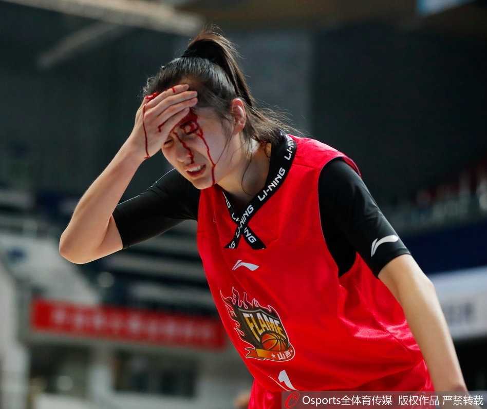 赛场铁血玫瑰:山西女篮郭子瑄头部重创血流满面仍昂首离场 受伤后的郭子瑄在队医和队友的搀扶下缓缓走向场边,她用手捂着头部的伤口,但神情依然坚毅,不甘就这样离开赛场。