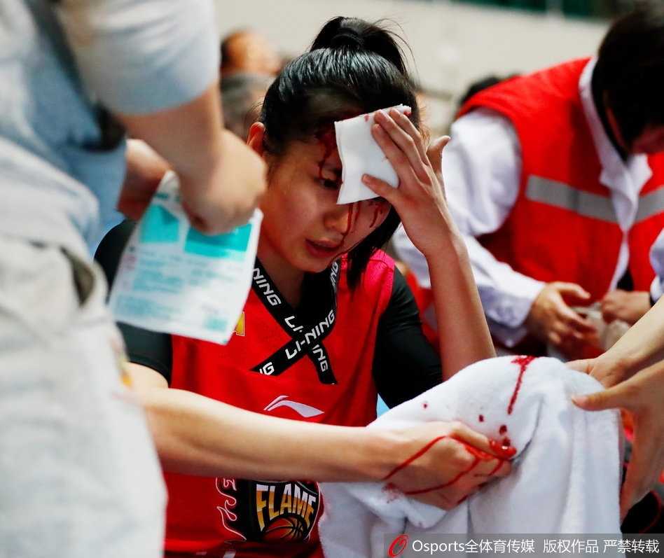 赛场铁血玫瑰:山西女篮郭子瑄头部重创血流满面仍昂首离场 终场哨响,队友们在场上激烈角逐,而场边的郭子瑄头部缠着厚厚的染血绷带,眼神复杂地注视着这一切,这一刻她的坚韧与无奈令人动容。