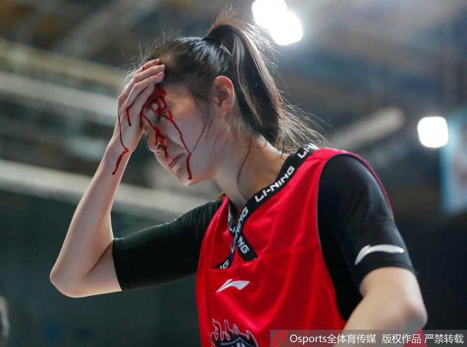 赛场铁血玫瑰:山西女篮郭子瑄头部重创血流满面仍昂首离场 受伤后的郭子瑄无法继续比赛,坐在替补席上关注着场上的战况,眼神中满是焦急与关切,心系球队胜负。